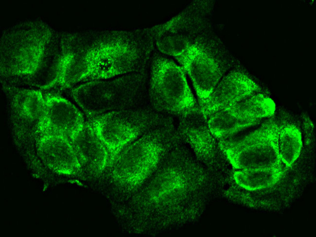 CD79b Antibody in Immunocytochemistry (ICC/IF)