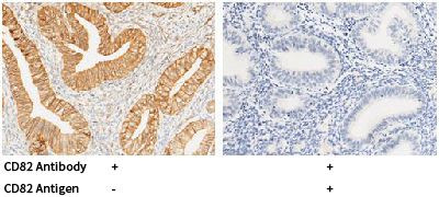 CD82 Antibody in Immunohistochemistry (Paraffin) (IHC (P))