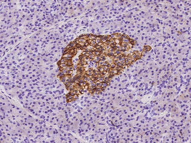 CD99 Antibody in Immunohistochemistry (Paraffin) (IHC (P))