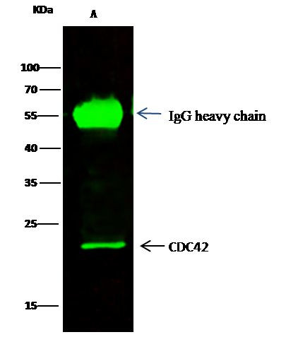 CDC42 Antibody in Immunoprecipitation (IP)