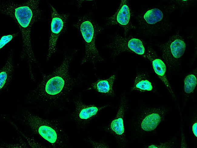 CDK4 Antibody in Immunocytochemistry (ICC/IF)