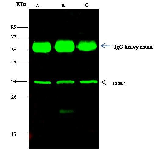 CDK4 Antibody in Immunoprecipitation (IP)