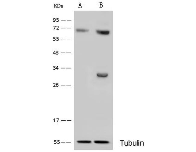 CDK4 Antibody in Western Blot (WB)