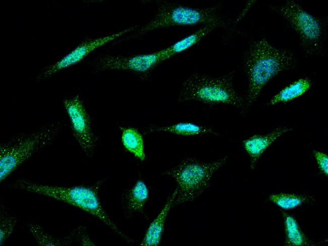 Chk1 Antibody in Immunocytochemistry (ICC/IF)