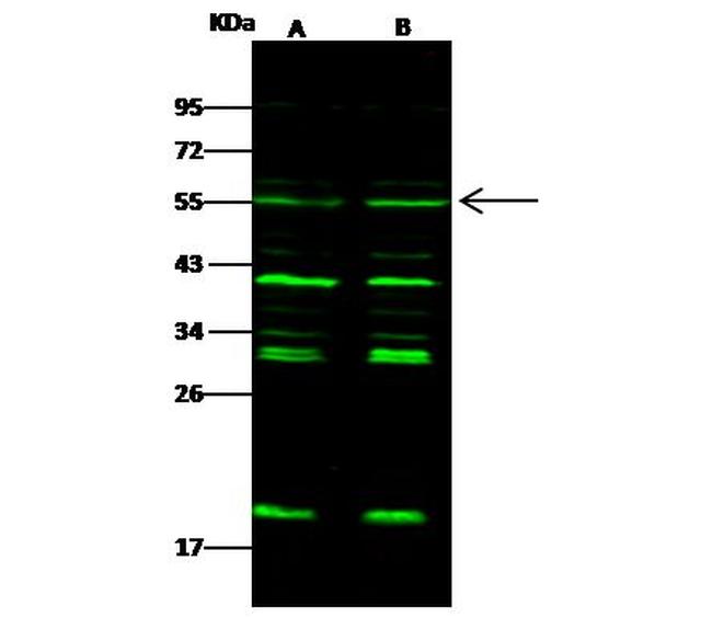 Chk1 Antibody in Western Blot (WB)