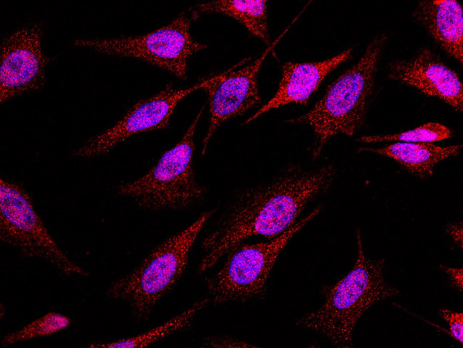 CIDEA Antibody in Immunocytochemistry (ICC/IF)