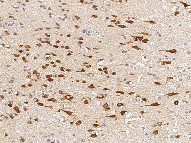 CIDEA Antibody in Immunohistochemistry (Paraffin) (IHC (P))