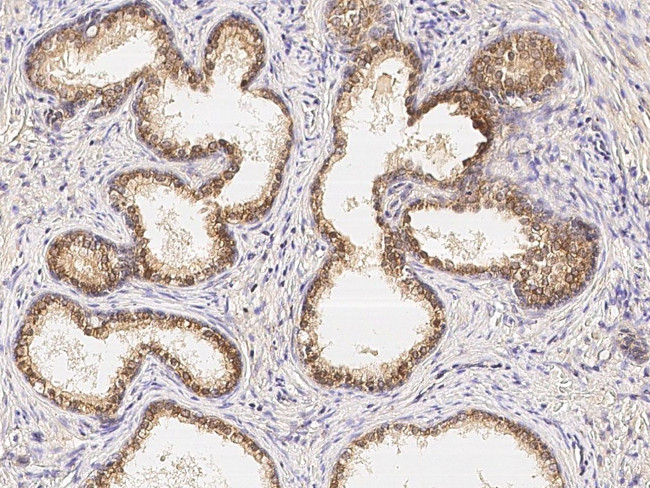 Claudin 3 Antibody in Immunohistochemistry (Paraffin) (IHC (P))