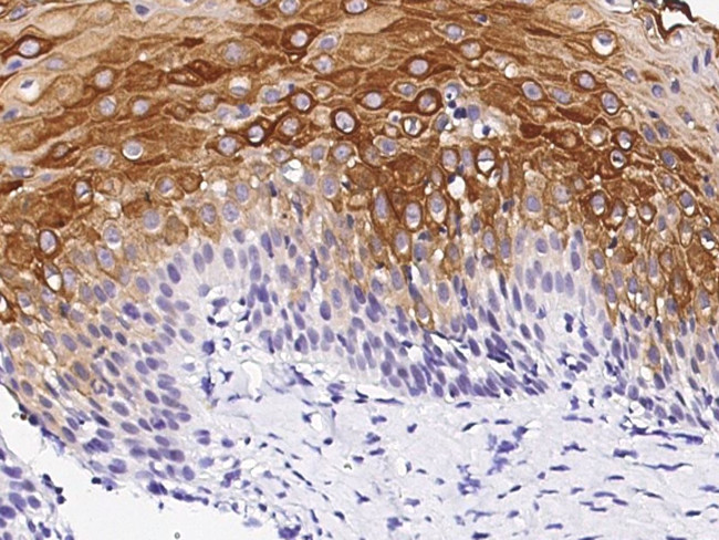 Claudin 4 Antibody in Immunohistochemistry (Paraffin) (IHC (P))