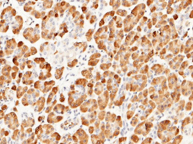 Carboxypeptidase A2 Antibody in Immunohistochemistry (Paraffin) (IHC (P))