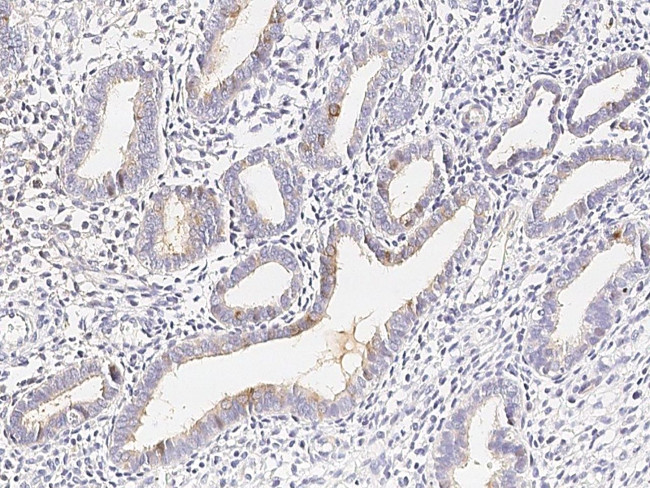 Carboxypeptidase M Antibody in Immunohistochemistry (Paraffin) (IHC (P))