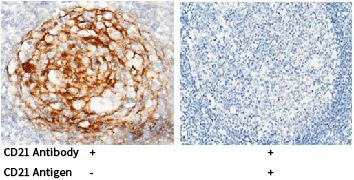 CD21 Antibody in Immunohistochemistry (Paraffin) (IHC (P))