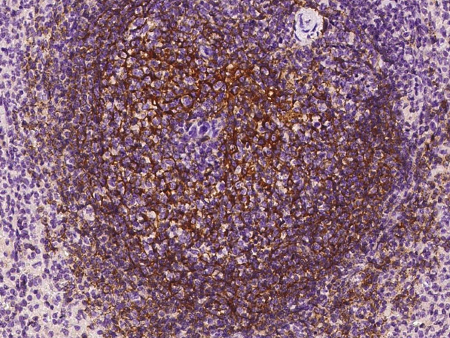 CD21 Antibody in Immunohistochemistry (Paraffin) (IHC (P))