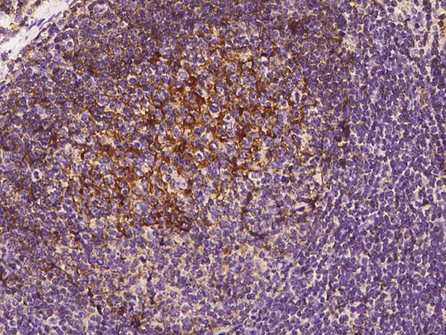 CD21 Antibody in Immunohistochemistry (Paraffin) (IHC (P))