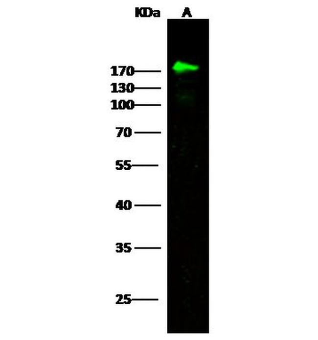 CD21 Antibody in Western Blot (WB)