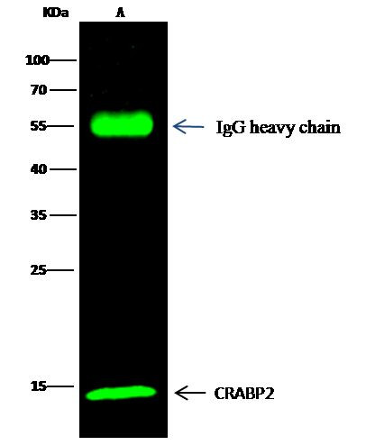 CRABP2 Antibody in Immunoprecipitation (IP)