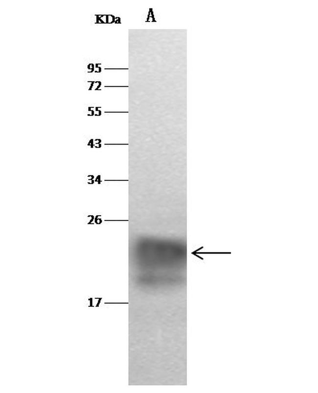 Cystatin F Antibody in Western Blot (WB)