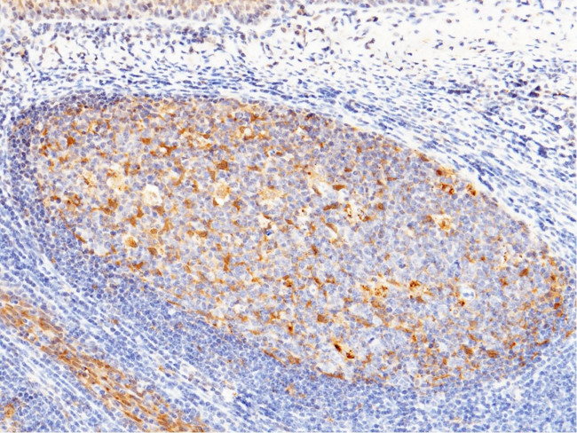 Cystatin A Antibody in Immunohistochemistry (Paraffin) (IHC (P))