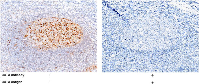 Cystatin A Antibody in Immunohistochemistry (Paraffin) (IHC (P))