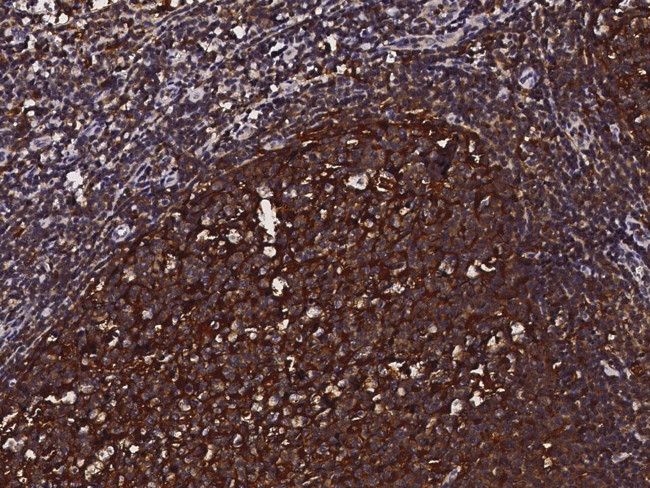 Cystatin A Antibody in Immunohistochemistry (Paraffin) (IHC (P))