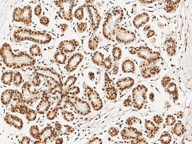 CtBP1 Antibody in Immunohistochemistry (Paraffin) (IHC (P))