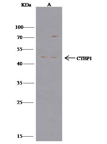 CtBP1 Antibody in Immunoprecipitation (IP)