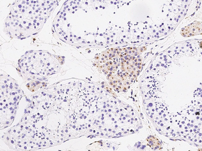 Cathepsin S Antibody in Immunohistochemistry (Paraffin) (IHC (P))