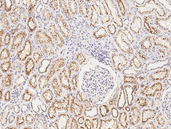 CUX1 Antibody in Immunohistochemistry (Paraffin) (IHC (P))