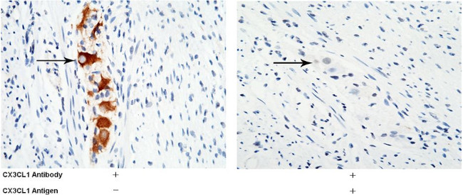 CX3CL1 Antibody in Immunohistochemistry (Paraffin) (IHC (P))