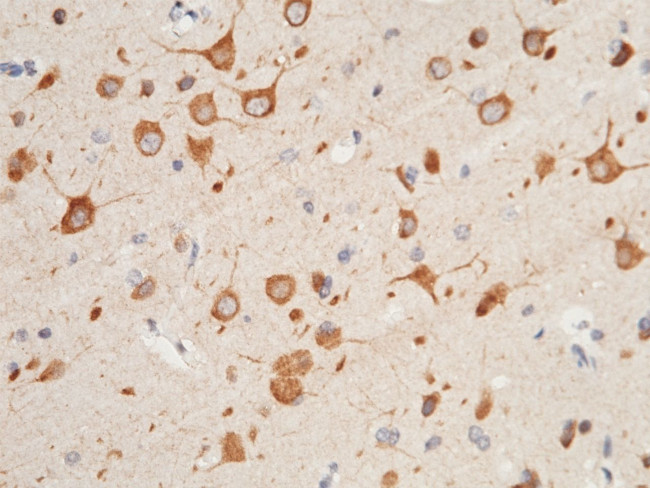 CX3CL1 Antibody in Immunohistochemistry (Paraffin) (IHC (P))