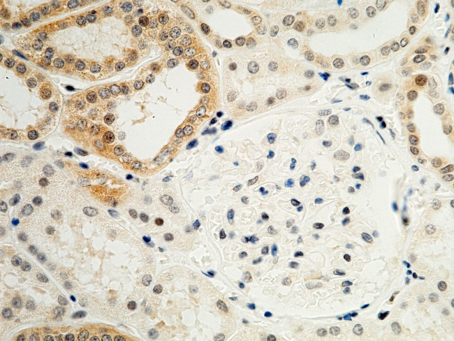 CX3CL1 Antibody in Immunohistochemistry (Paraffin) (IHC (P))