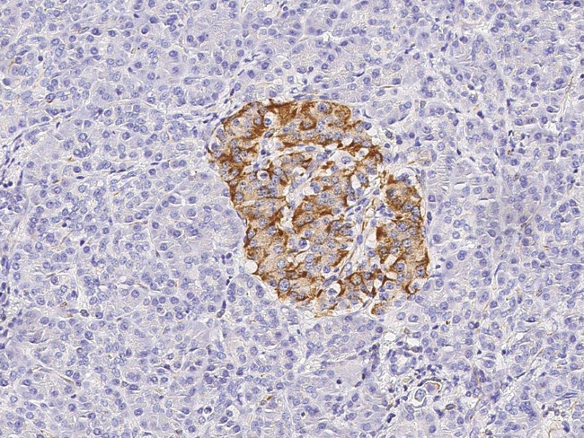 CXCL5 Antibody in Immunohistochemistry (Paraffin) (IHC (P))