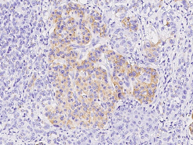 CXCL5 Antibody in Immunohistochemistry (Paraffin) (IHC (P))