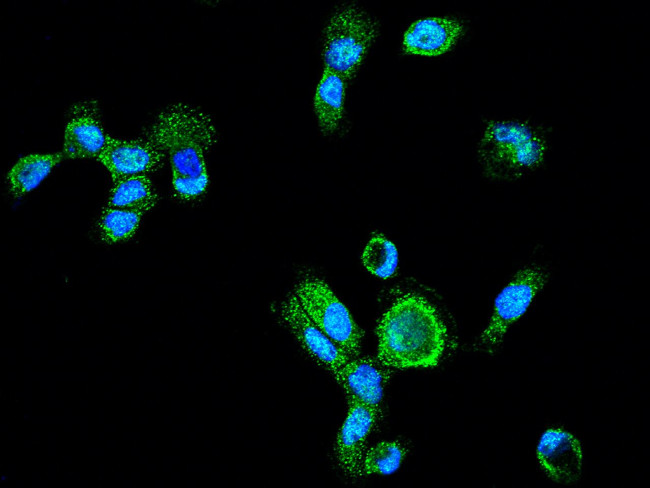 LAP3 Antibody in Immunocytochemistry (ICC/IF)