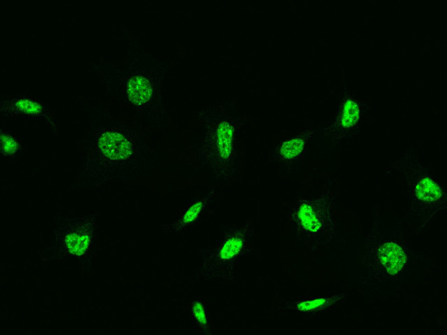 ZIPK Antibody in Immunocytochemistry (ICC/IF)