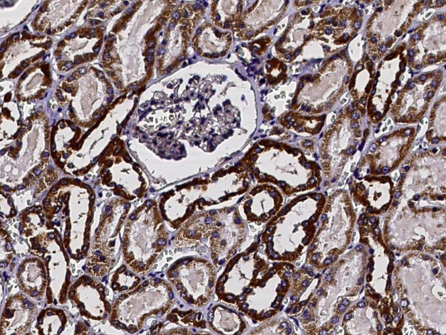 XTP3TPA Antibody in Immunohistochemistry (Paraffin) (IHC (P))