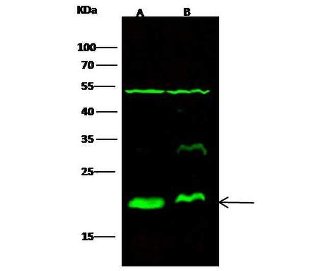 XTP3TPA Antibody in Western Blot (WB)