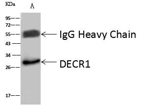 DECR1 Antibody in Immunoprecipitation (IP)