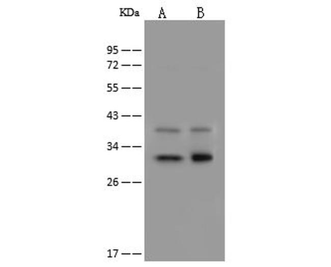 DECR1 Antibody in Western Blot (WB)