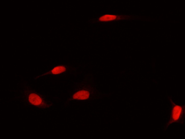 DNMT1 Antibody in Immunocytochemistry (ICC/IF)