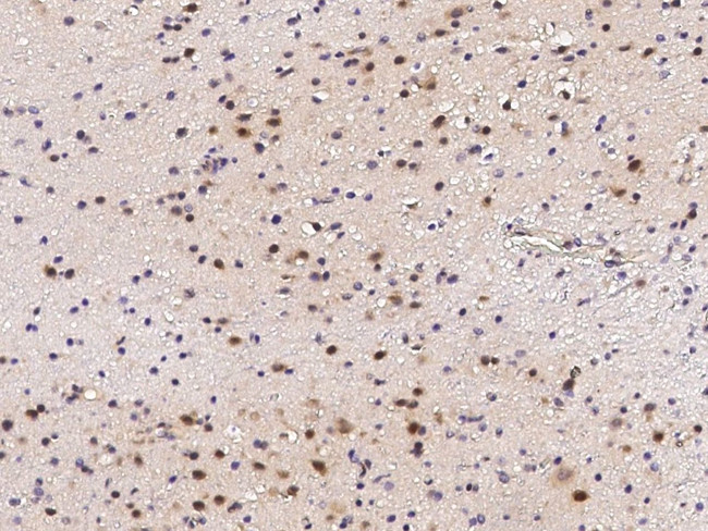 DNMT1 Antibody in Immunohistochemistry (Paraffin) (IHC (P))