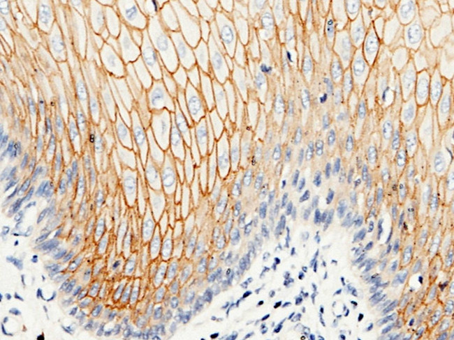 Desmocollin 2 Antibody in Immunohistochemistry (Paraffin) (IHC (P))