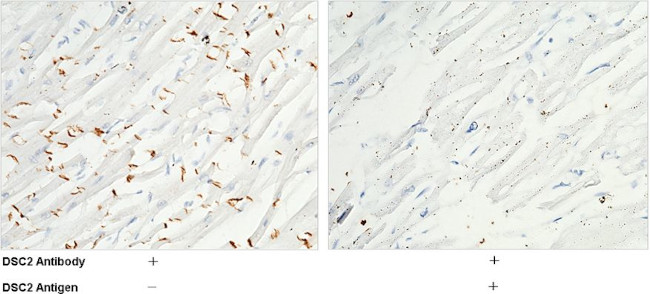 Desmocollin 2 Antibody in Immunohistochemistry (Paraffin) (IHC (P))