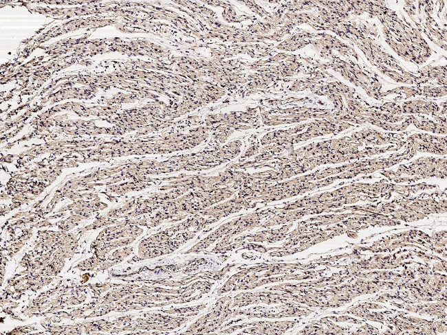 RCAS1 Antibody in Immunohistochemistry (Paraffin) (IHC (P))