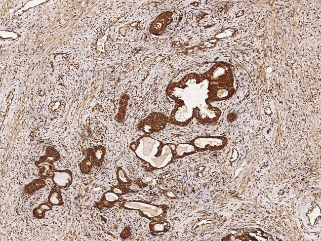 RCAS1 Antibody in Immunohistochemistry (Paraffin) (IHC (P))