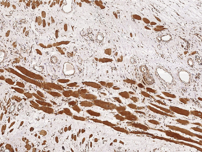 RCAS1 Antibody in Immunohistochemistry (Paraffin) (IHC (P))