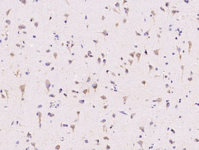 ECSIT Antibody in Immunohistochemistry (Paraffin) (IHC (P))