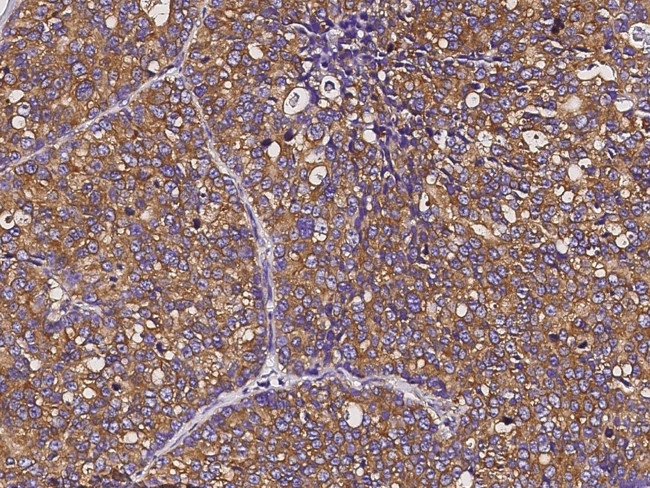 EEF1B2 Antibody in Immunohistochemistry (Paraffin) (IHC (P))