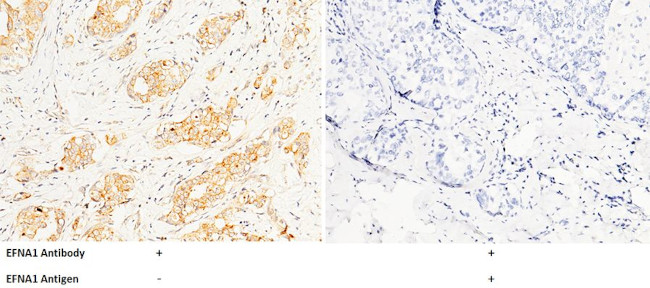 Ephrin A1 Antibody in Immunohistochemistry (Paraffin) (IHC (P))