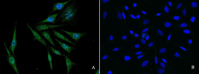 EGR1 Antibody in Immunocytochemistry (ICC/IF)